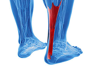 Achilles tendon treatment in the San Diego County, CA: Oceanside (Carlsbad, Vista, San Marcos, Escondido, Encinitas, Solana Beach, Valley Center, Poway, Camp Pendleton North, Fall Brook) areas