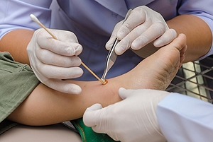 What Should I Do If I See a Wound on My Foot?
