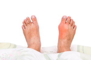 What is Sesamoiditis?