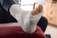 What to Know About a Broken Foot