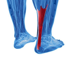 Pain in the Calf and Heel Area