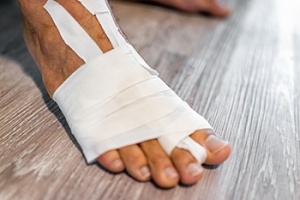 Turf Toe and Protecting Your Big Toe Joint