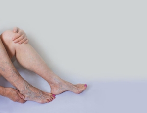 Foot Care for the Elderly