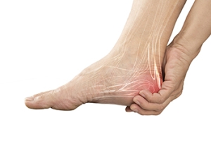 What Is Plantar Fasciitis?