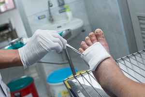 Possible Methods for Wound Treatment